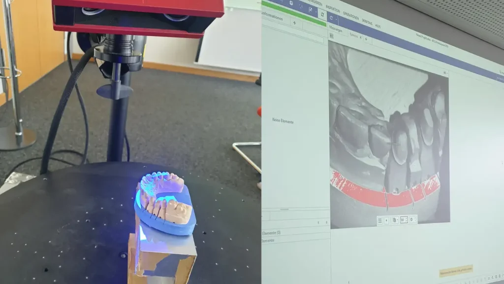 3D-Scan eines Zahnmodells